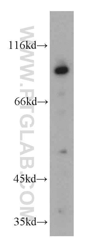 Western Blot (WB) analysis of A431 cells using ERCC3 Polyclonal antibody (10580-1-AP)