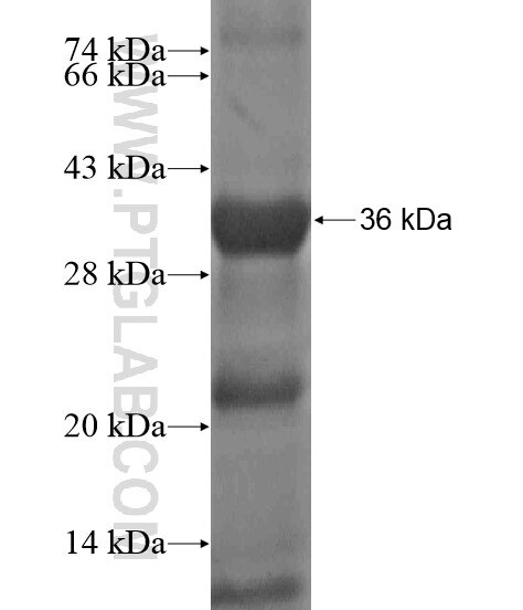 ERCC3 fusion protein Ag20286 SDS-PAGE