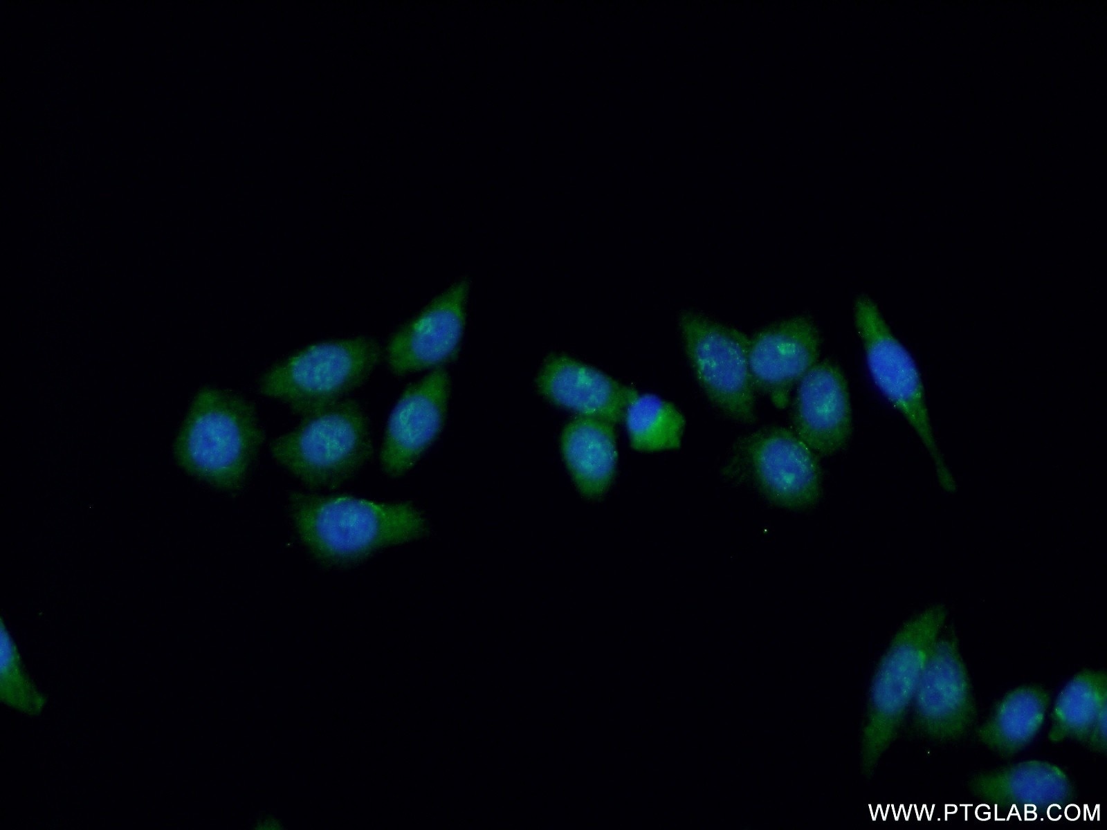 Immunofluorescence (IF) / fluorescent staining of HeLa cells using XPG Polyclonal antibody (11331-1-AP)