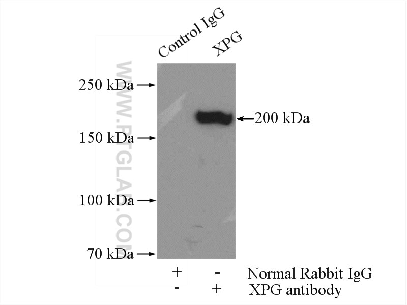 Immunoprecipitation (IP) experiment of HeLa cells using XPG Polyclonal antibody (11331-1-AP)