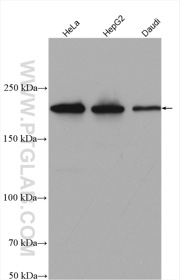 Western Blot (WB) analysis of various lysates using XPG Polyclonal antibody (11331-1-AP)