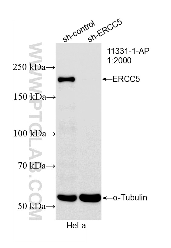 Western Blot (WB) analysis of HeLa cells using XPG Polyclonal antibody (11331-1-AP)