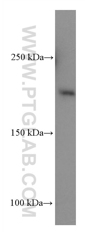 Western Blot (WB) analysis of COLO 320 cells using ERCC5 Monoclonal antibody (67055-1-Ig)