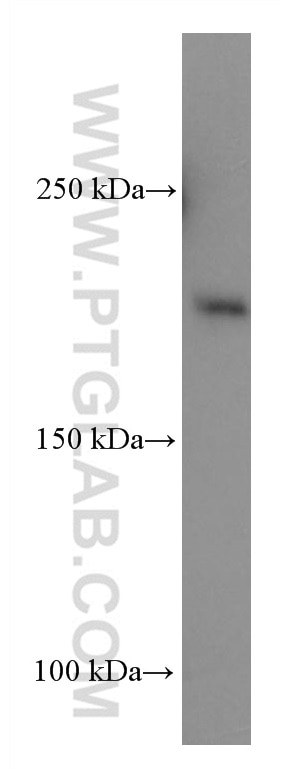WB analysis of COLO 320 using 67055-1-Ig