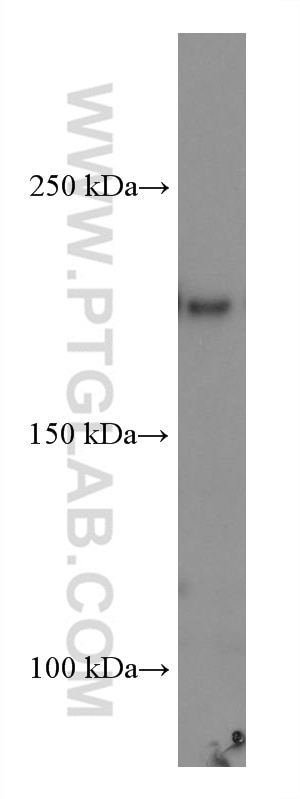 Western Blot (WB) analysis of Daudi cells using ERCC5 Monoclonal antibody (67055-1-Ig)