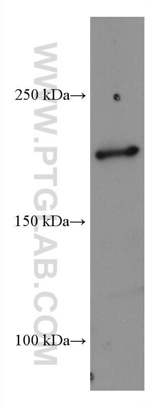 Western Blot (WB) analysis of Ramos cells using ERCC5 Monoclonal antibody (67055-1-Ig)
