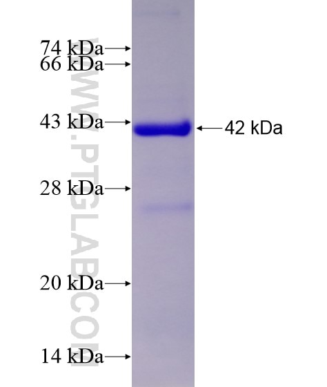 ERCC5 fusion protein Ag28561 SDS-PAGE