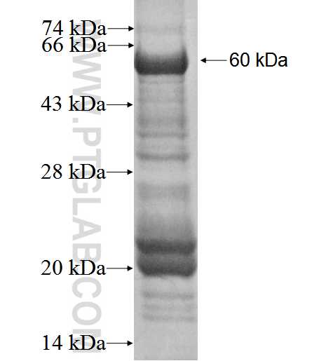 ERCC5 fusion protein Ag1874 SDS-PAGE