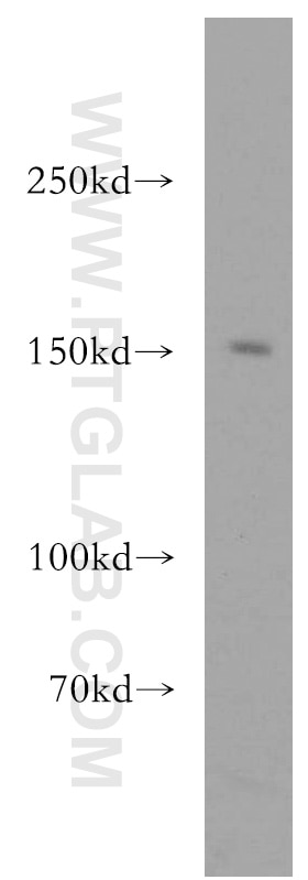 Western Blot (WB) analysis of mouse brain tissue using ERCC6/CSB Polyclonal antibody (20548-1-AP)