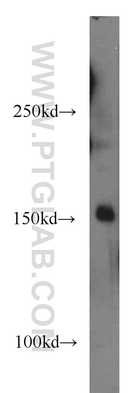 Western Blot (WB) analysis of mouse brain tissue using ERCC6/CSB Polyclonal antibody (20548-1-AP)