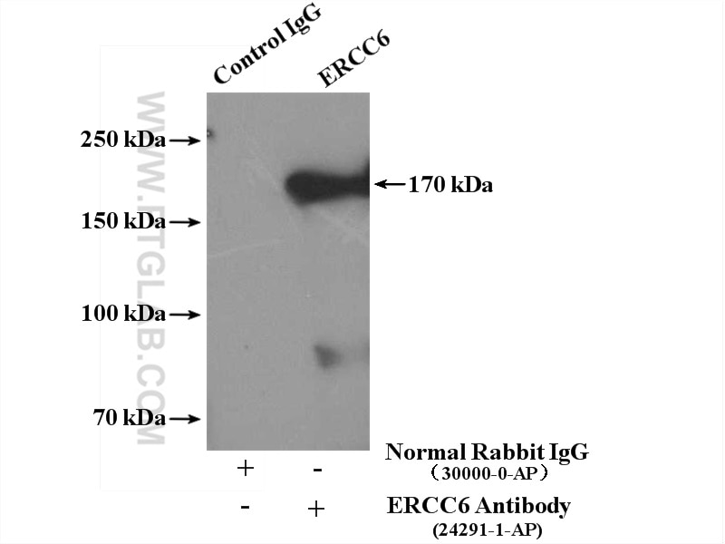 Immunoprecipitation (IP) experiment of HeLa cells using ERCC6/CSB Polyclonal antibody (24291-1-AP)