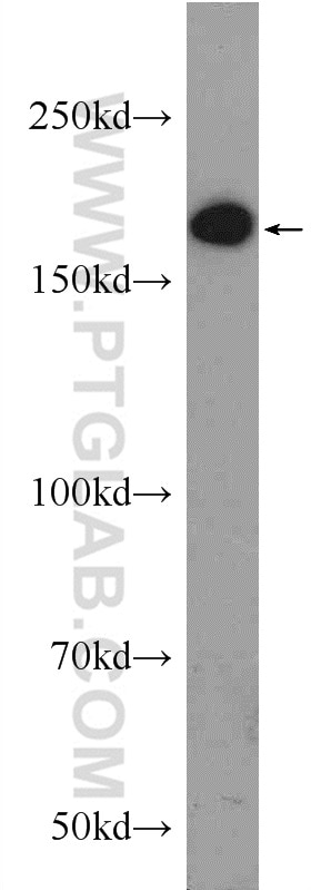 Western Blot (WB) analysis of HeLa cells using ERCC6/CSB Polyclonal antibody (24291-1-AP)