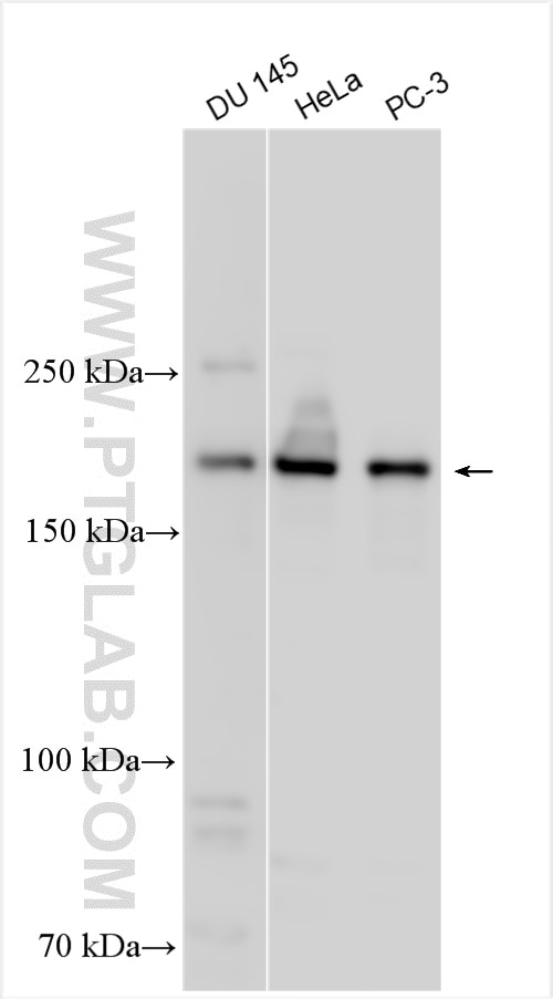 Western Blot (WB) analysis of various lysates using ERCC6/CSB Polyclonal antibody (24291-1-AP)