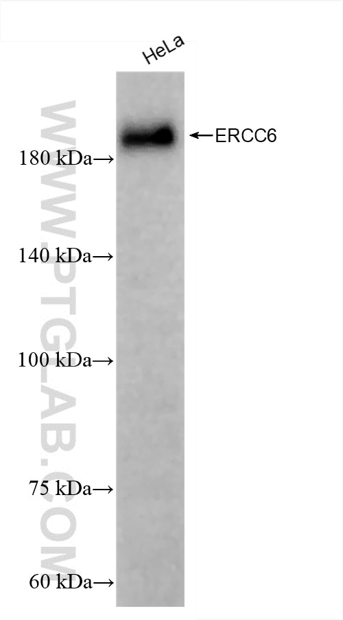 ERCC6