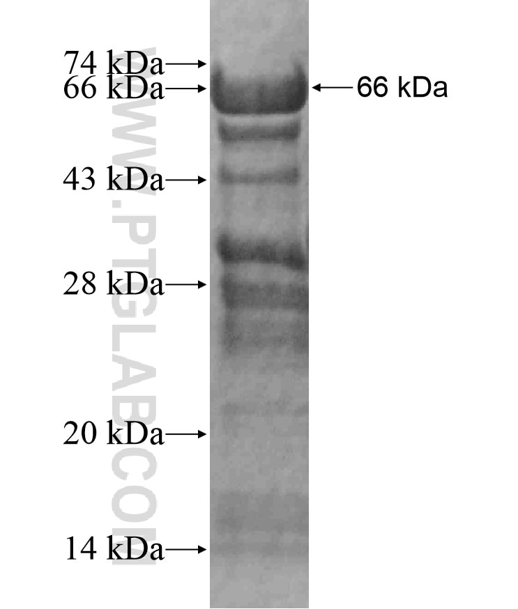 ERCC6 fusion protein Ag18009 SDS-PAGE