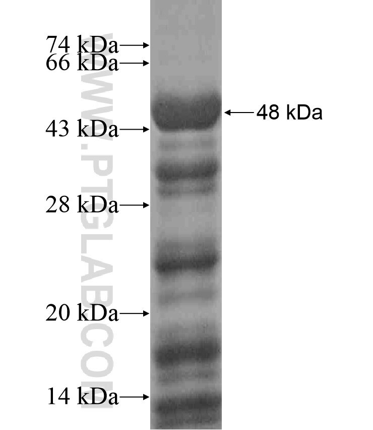 ERCC6 fusion protein Ag18260 SDS-PAGE