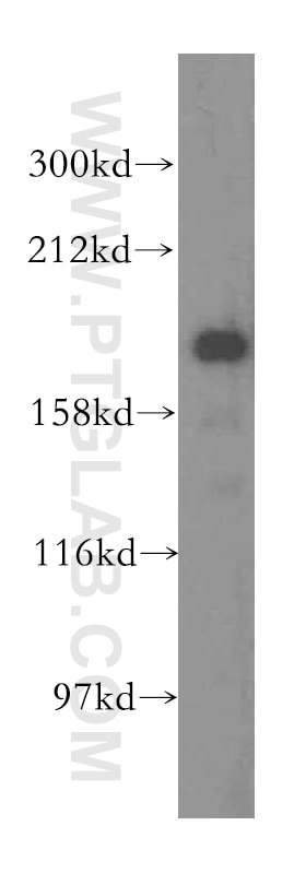 Western Blot (WB) analysis of human heart tissue using ERCC6L Polyclonal antibody (15688-1-AP)