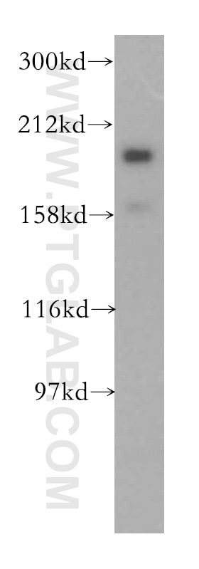Western Blot (WB) analysis of mouse lung tissue using ERCC6L Polyclonal antibody (15688-1-AP)