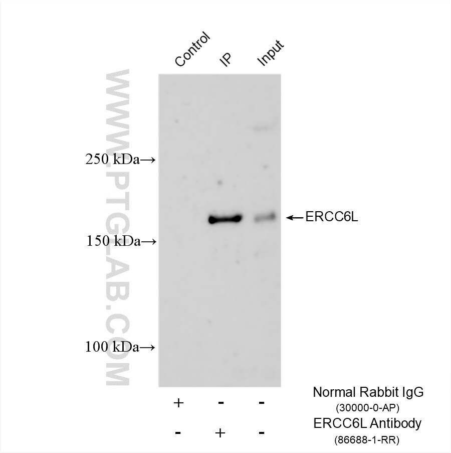 Immunoprecipitation (IP) experiment of K-562 cells using ERCC6L Recombinant monoclonal antibody (86688-1-RR)