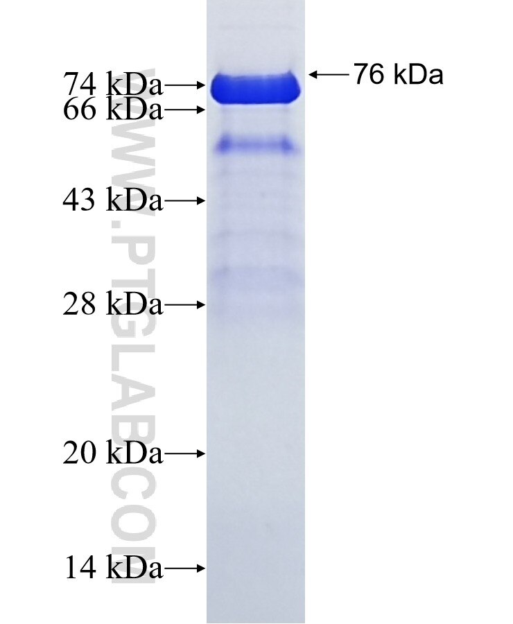 ERCC6L fusion protein Ag8223 SDS-PAGE