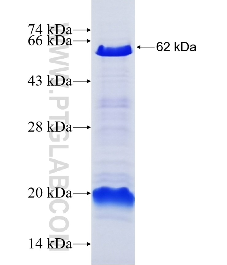 ERCC6L fusion protein Ag8238 SDS-PAGE