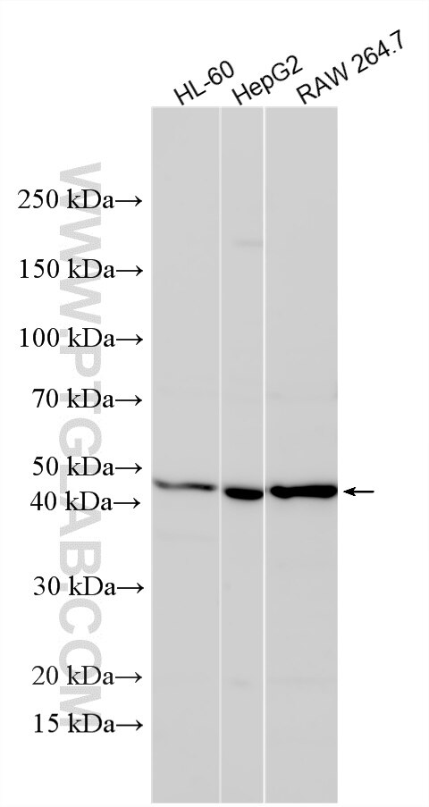 Various lysates were subjected to SDS PAGE followed by western blot with 15921-1-AP (ERCC8 antibody) at dilution of 1:800 incubated at room temperature for 1.5 hours. Western Blot (WB) analysis of various lysates using ERCC8 Polyclonal antibody (15921-1-AP)