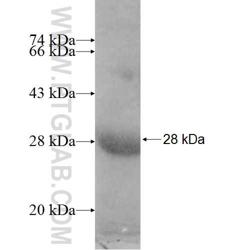 ERCC8 fusion protein Ag9096 SDS-PAGE