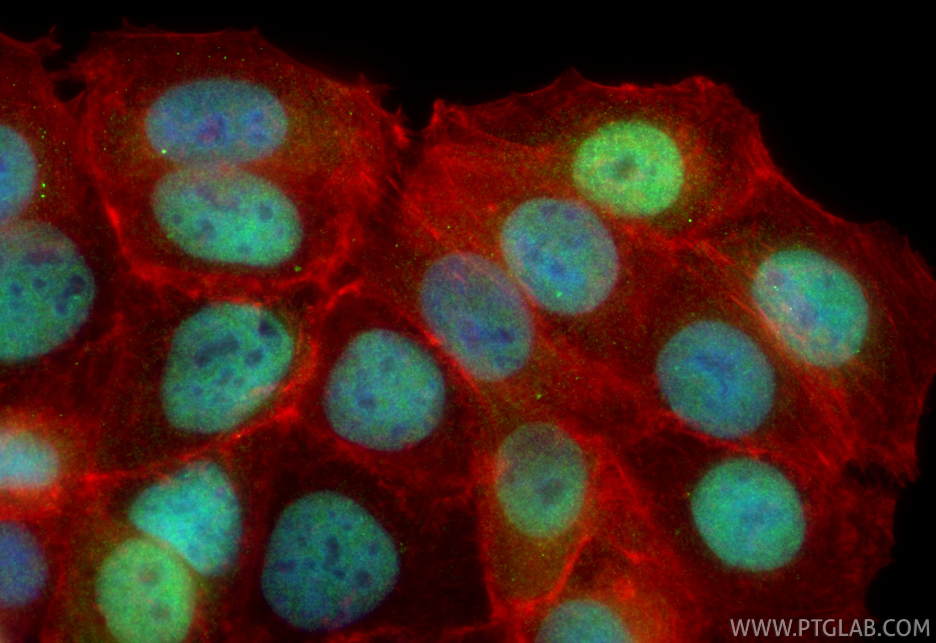 Immunofluorescence (IF) / fluorescent staining of MCF-7 cells using ERF Polyclonal antibody (26468-1-AP)
