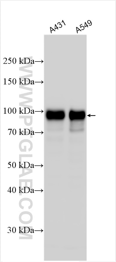Western Blot (WB) analysis of various lysates using ERF Polyclonal antibody (26468-1-AP)