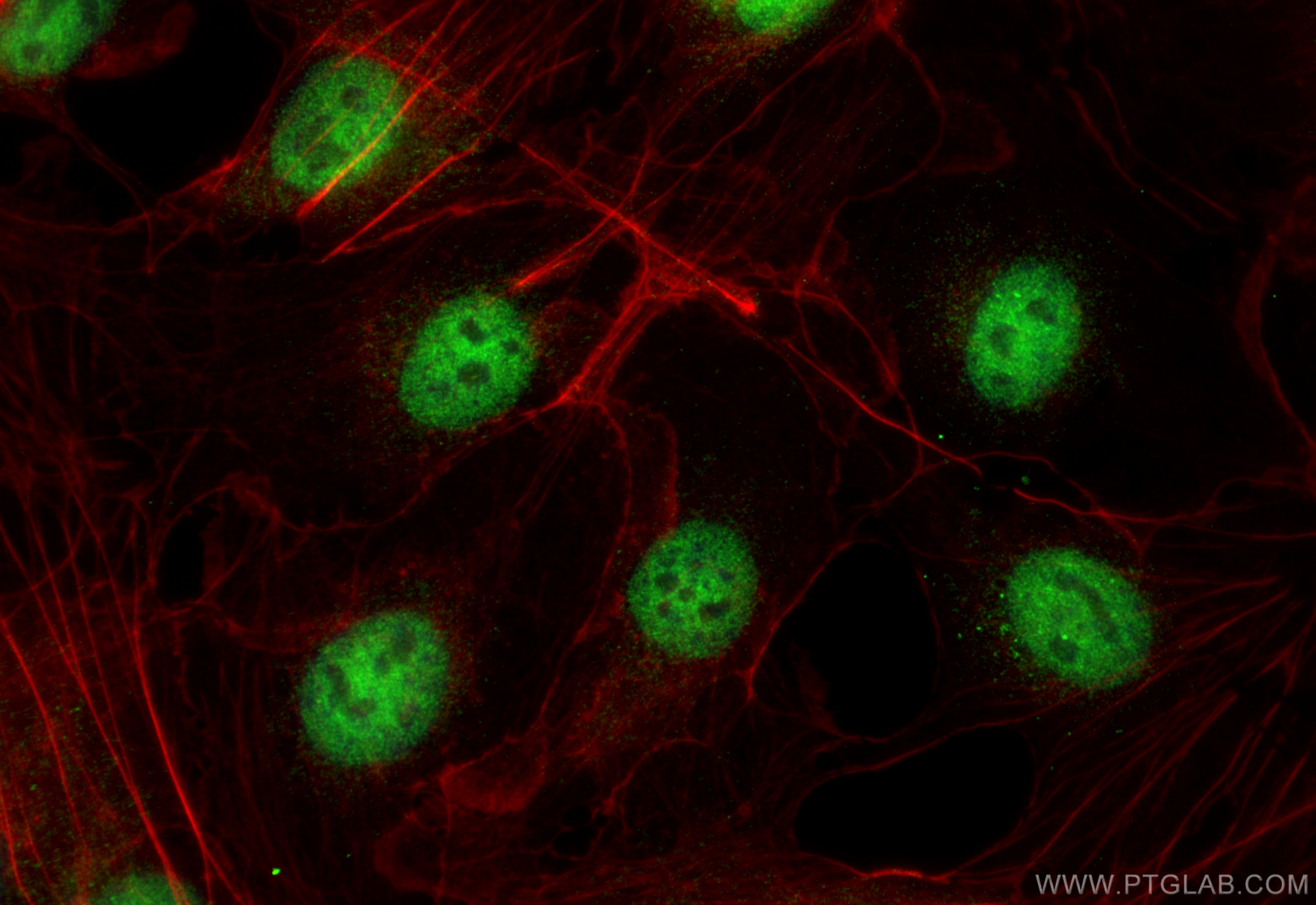 Immunofluorescence (IF) / fluorescent staining of HUVEC cells using ERG Polyclonal antibody (14356-1-AP)