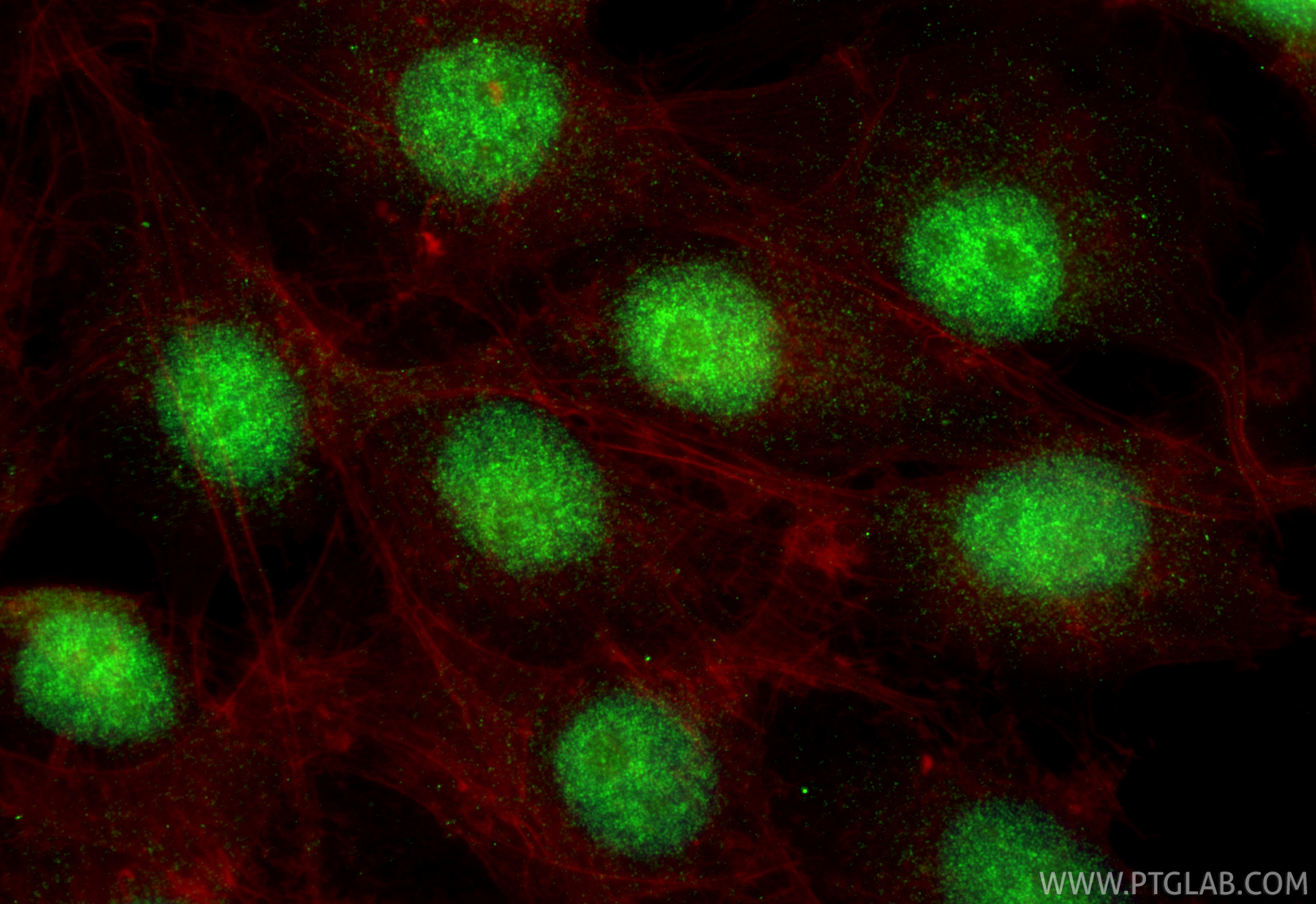 Immunofluorescence (IF) / fluorescent staining of MG-63 cells using ERG Polyclonal antibody (14356-1-AP)