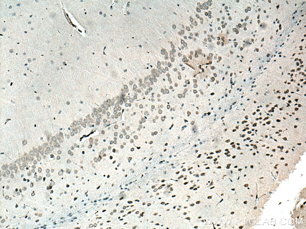 Immunohistochemistry (IHC) staining of mouse brain tissue using ERG Polyclonal antibody (14356-1-AP)