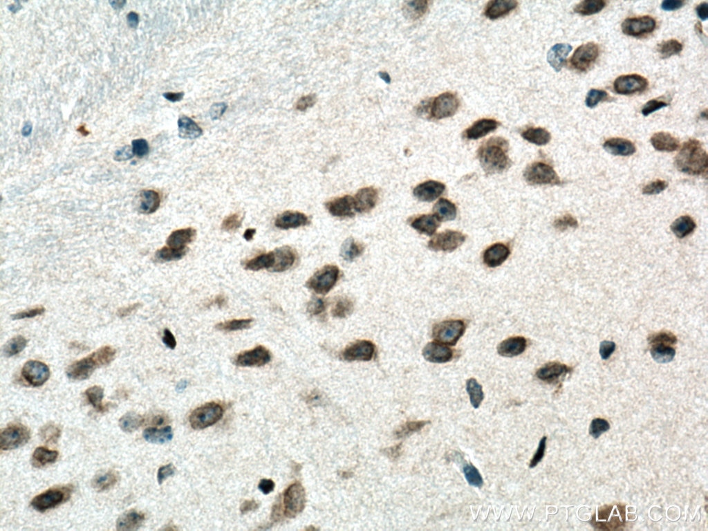Immunohistochemistry (IHC) staining of mouse brain tissue using ERG Polyclonal antibody (14356-1-AP)
