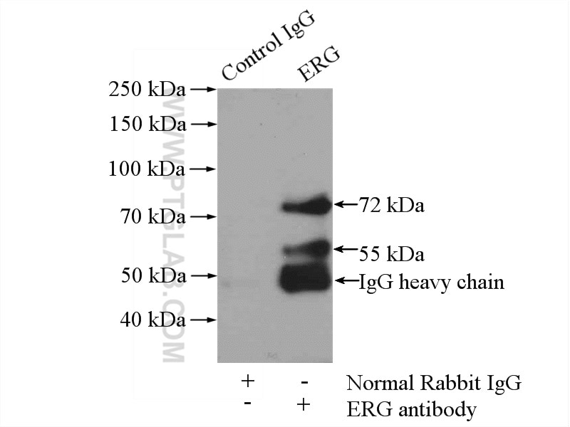Immunoprecipitation (IP) experiment of MCF-7 cells using ERG Polyclonal antibody (14356-1-AP)