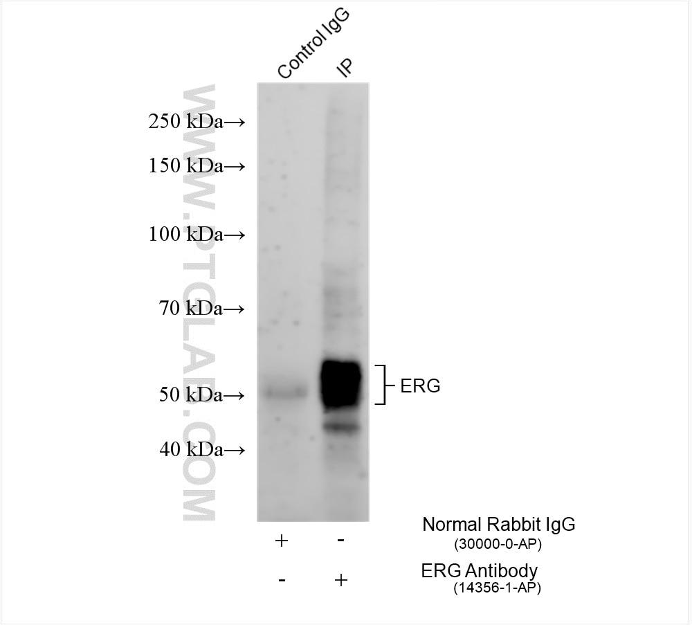 Immunoprecipitation (IP) experiment of rat heart tissue using ERG Polyclonal antibody (14356-1-AP)