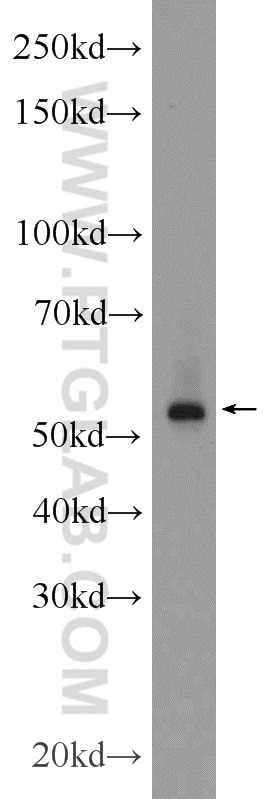 Western Blot (WB) analysis of MCF-7 cells using ERG Polyclonal antibody (14356-1-AP)