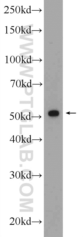Western Blot (WB) analysis of MCF-7 cells using ERG Polyclonal antibody (14356-1-AP)