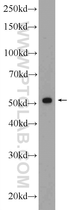 WB analysis of MCF-7 using 14356-1-AP