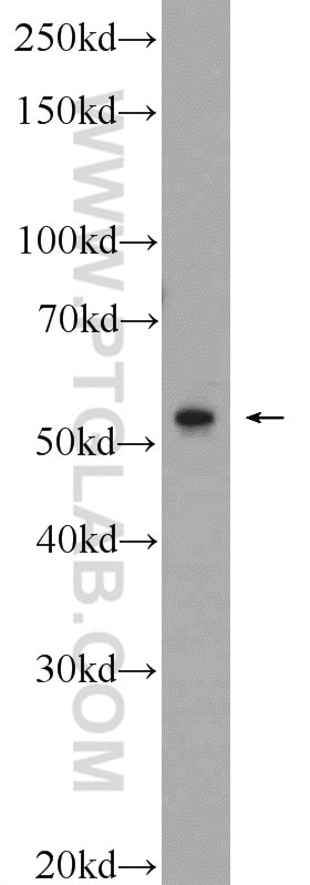 Western Blot (WB) analysis of MCF-7 cells using ERG Polyclonal antibody (14356-1-AP)