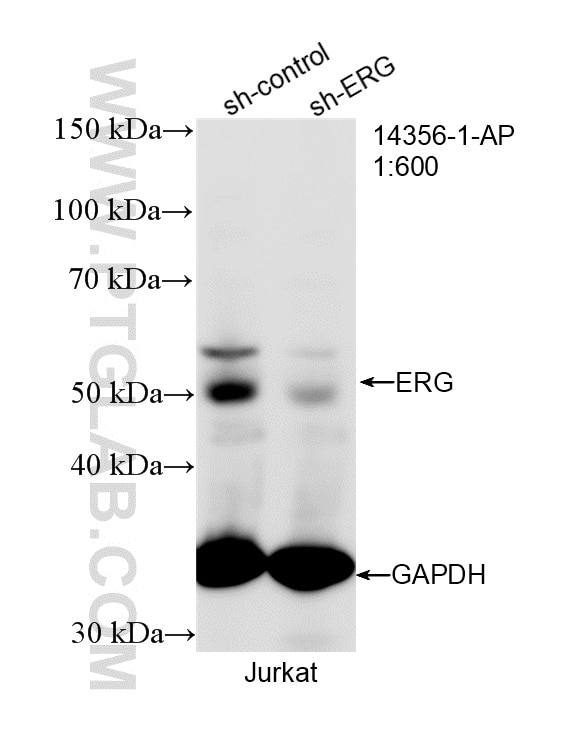 WB analysis of Jurkat using 14356-1-AP Western Blot (WB) analysis of Jurkat cells using ERG Polyclonal antibody (14356-1-AP)