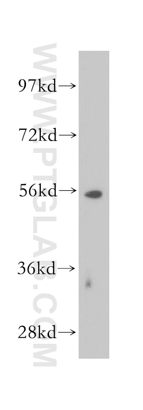 Western Blot (WB) analysis of HEK-293 cells using ERG Polyclonal antibody (14356-1-AP)