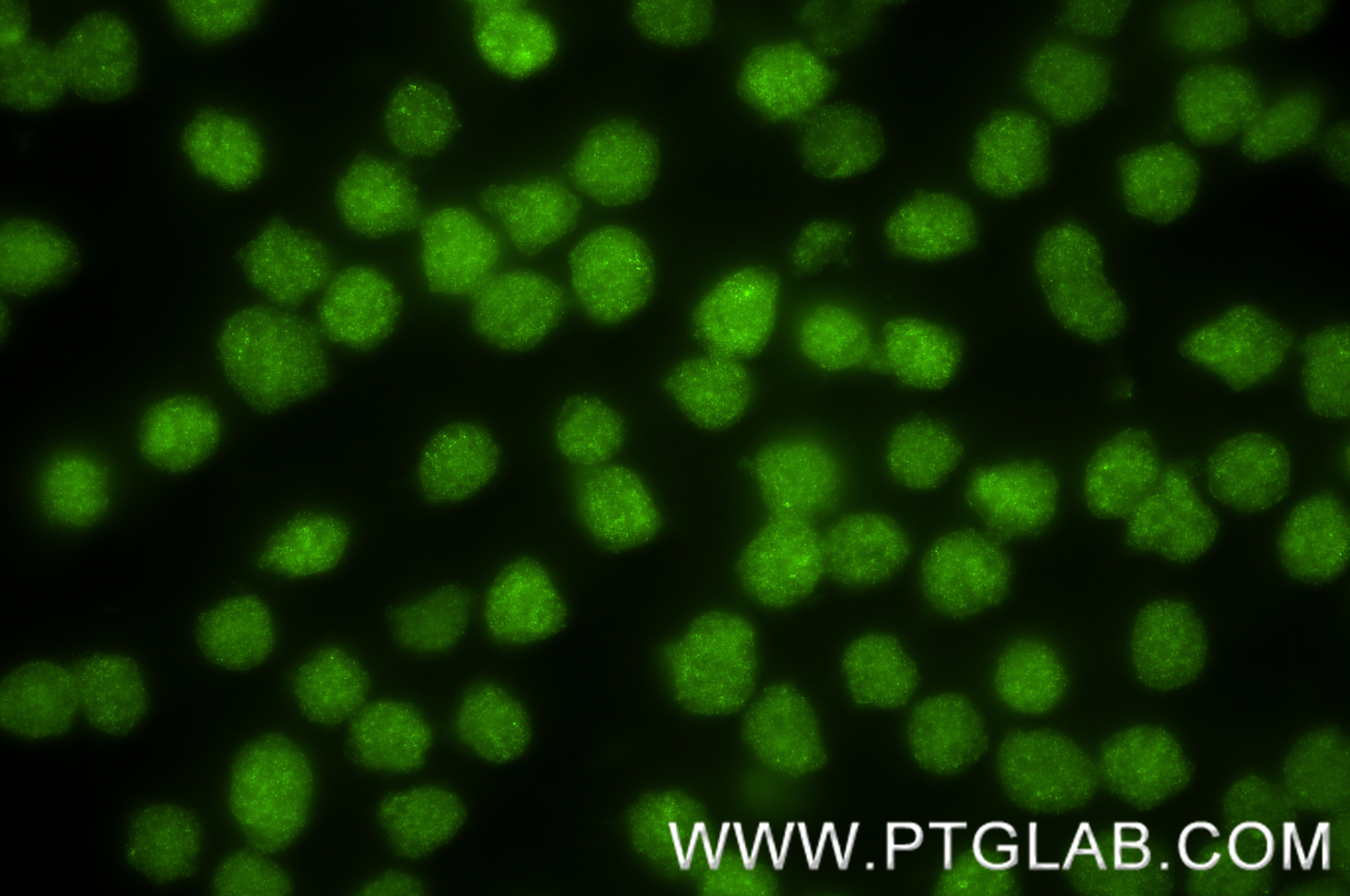 IF Staining of MOLT-4 using 88009-1-RR (same clone as 88009-1-PBS) Immunofluorescence (IF) / fluorescent staining of MOLT-4 cells using ERG Recombinant monoclonal antibody (88009-1-RR)
