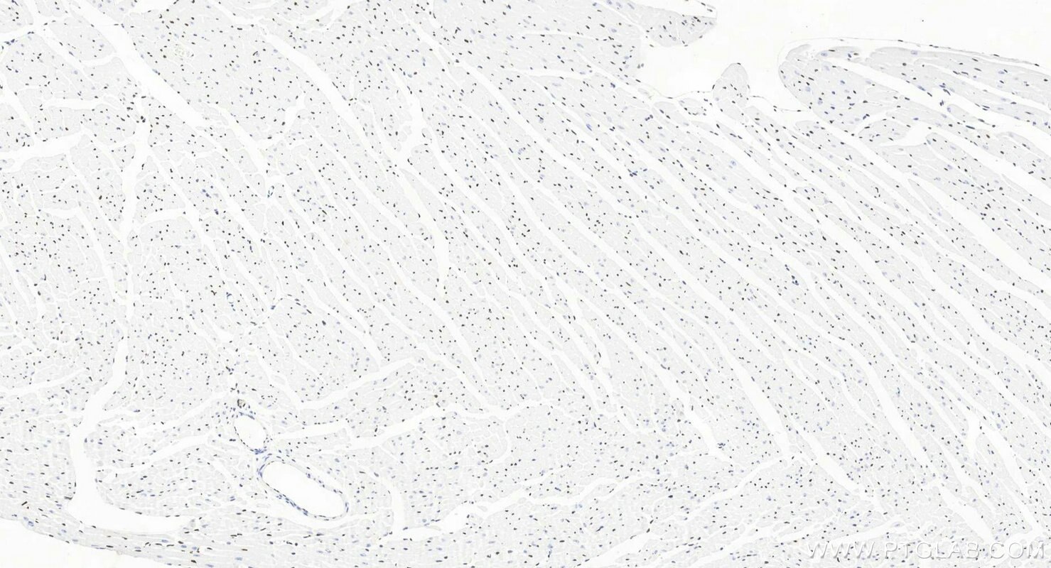 Immunohistochemistry (IHC) staining of mouse heart tissue using ERG Recombinant monoclonal antibody (88009-1-RR)