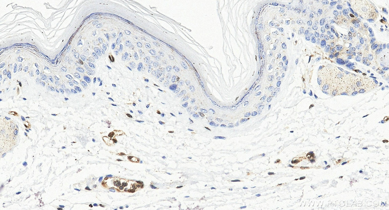 Immunohistochemistry (IHC) staining of mouse skin tissue using ERG Recombinant monoclonal antibody (88009-1-RR)