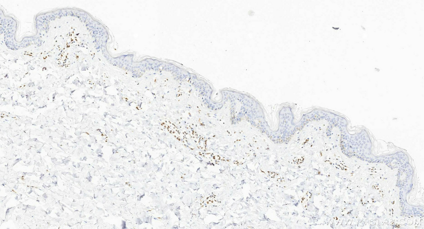 Immunohistochemistry (IHC) staining of human skin tissue using ERG Recombinant monoclonal antibody (88009-1-RR)