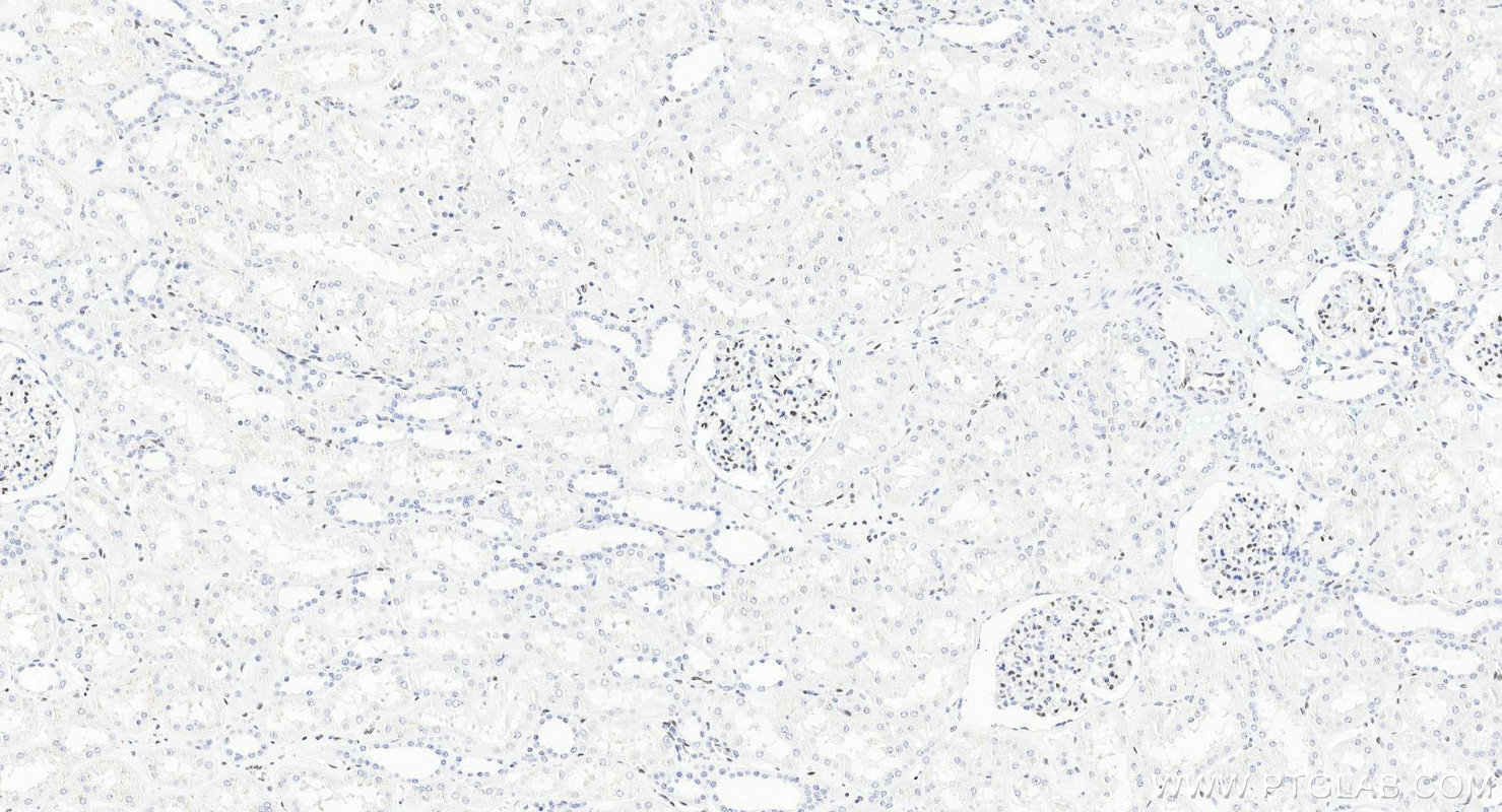Immunohistochemistry (IHC) staining of human kidney tissue using ERG Recombinant monoclonal antibody (88009-1-RR)