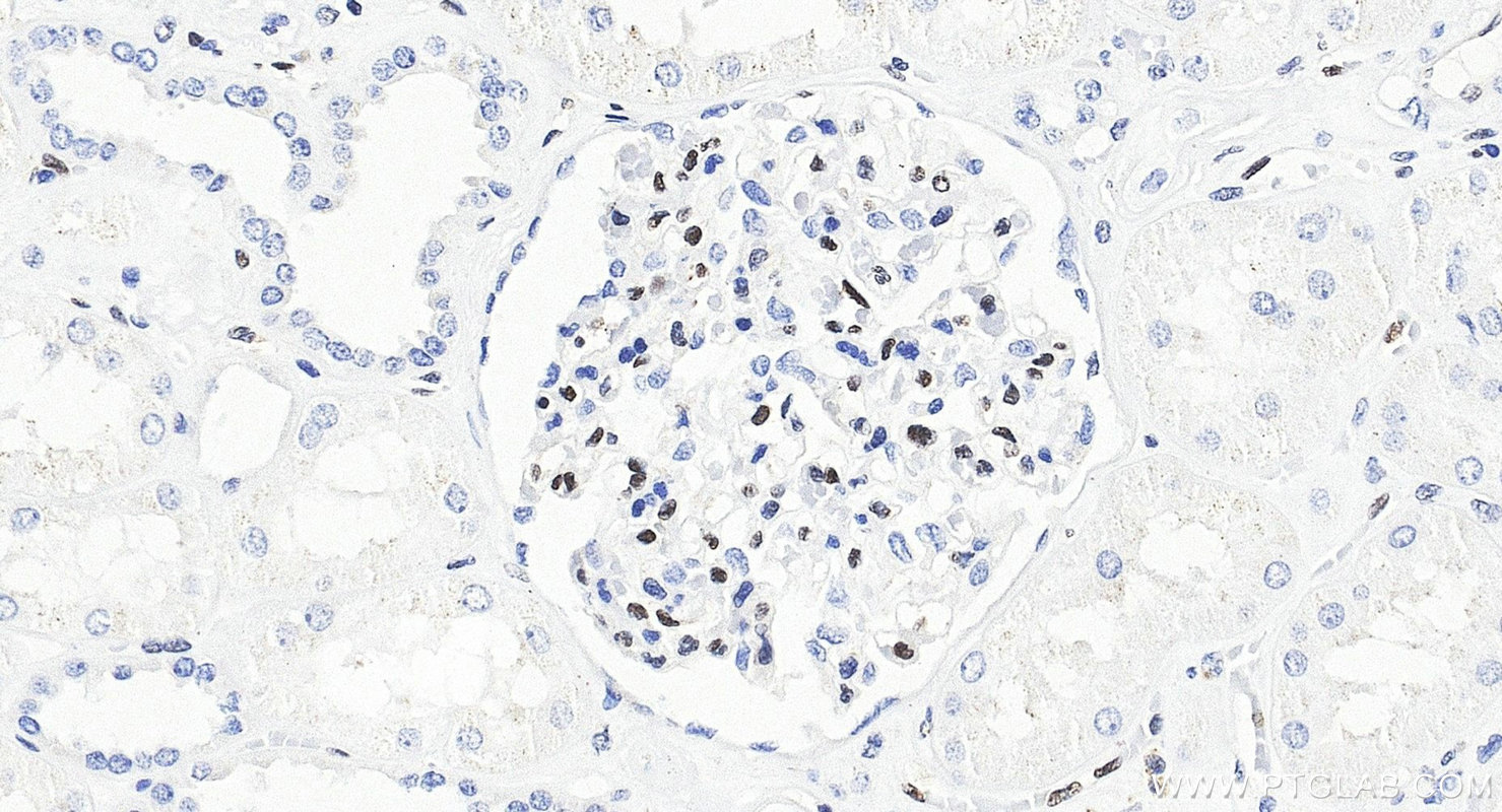 Immunohistochemistry (IHC) staining of human kidney tissue using ERG Recombinant monoclonal antibody (88009-1-RR)