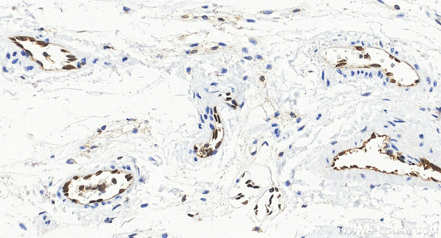 Immunohistochemistry (IHC) staining of mouse skin tissue using ERG Recombinant monoclonal antibody (88009-1-RR)