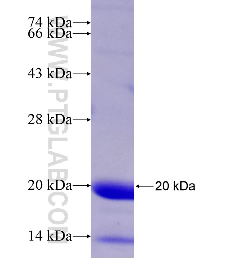 ERG fusion protein Ag17464 SDS-PAGE ERG fusion protein Ag17464 SDS-PAGE