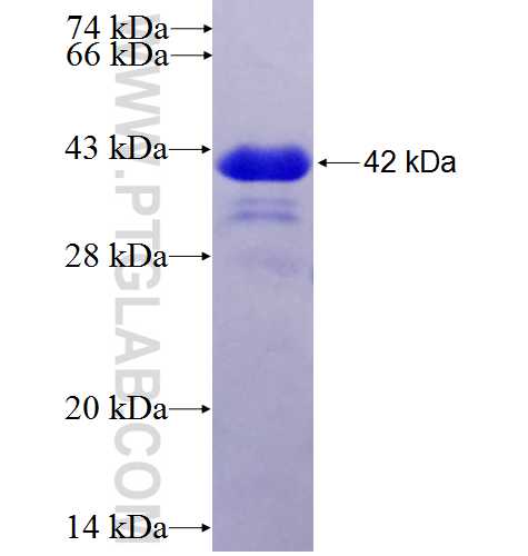 ERG fusion protein Ag5708 SDS-PAGE